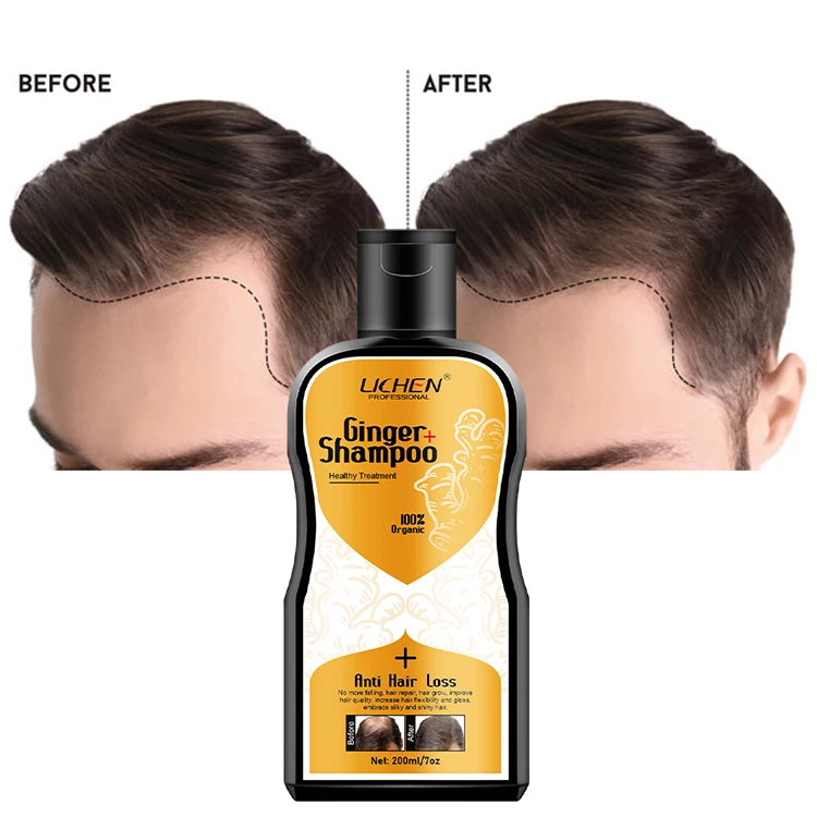 Private label anti-hair loss shampoo best shampoo for hair loss anti hair fall shampoo