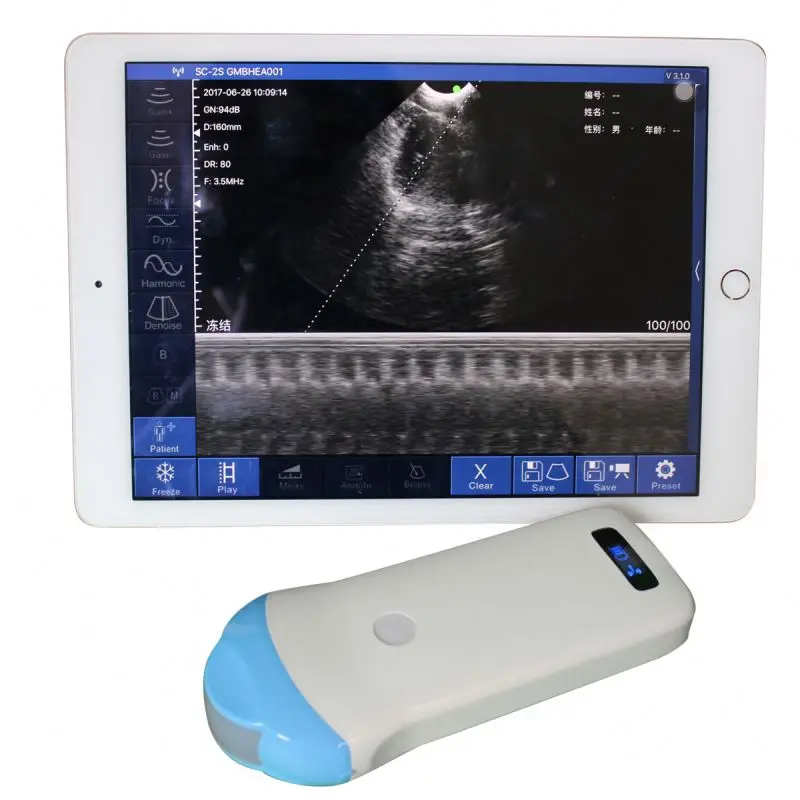portable handheld baby ultrasound machine 128 Elements Wireless micro-convex ultrasound medical ultrasound Scanner for baby
