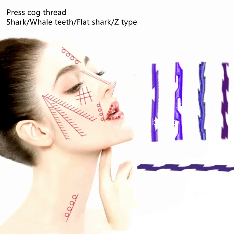 Hilos Tensores 30g 25mm Korea Barbed Lip Filling Sharp Needle Mono Pdo Threads