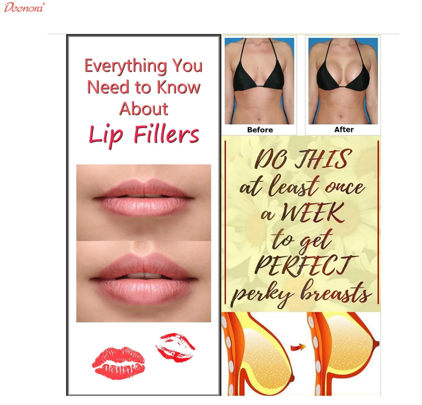 Корейский наполнитель Deenora ha флаконы для губ увеличение сексуальных инъекции омоложения кожи с гиалуроновой кислотой дермальный в шприце