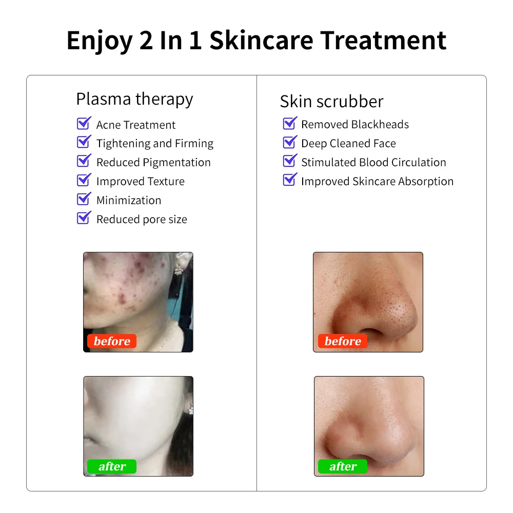 Плазменная Ручка для домашнего ухода за кожей самые популярные товары Новые поступления устройство подтяжки лица Самые продаваемые косметические устройства