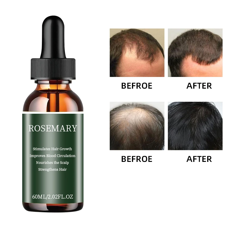 OEM Private brand Organic Natural Vegetarian Nourishing Hair Repair Growth Hair Care Essential Oil Rosemary Essential oil