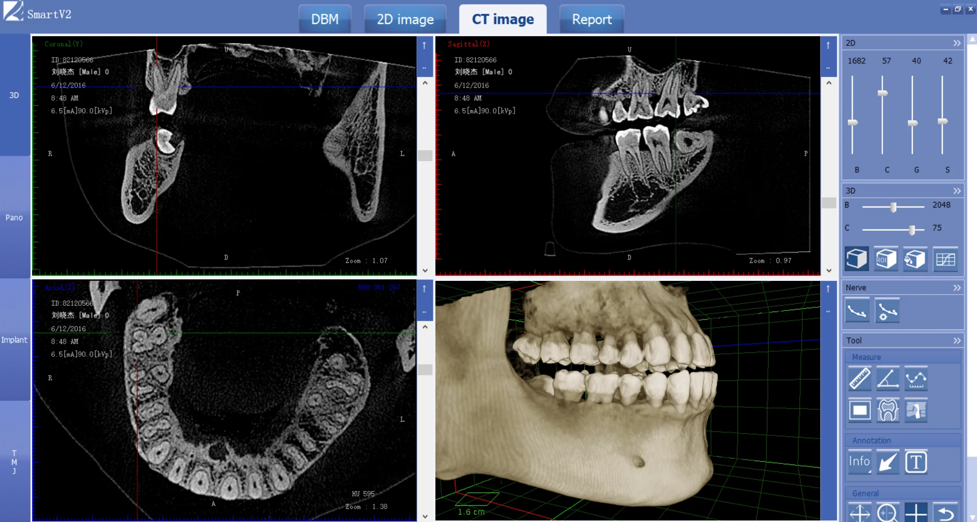 
Professional best selling Cone beam CT multifunctional dental CBCT Radiology Equipment 