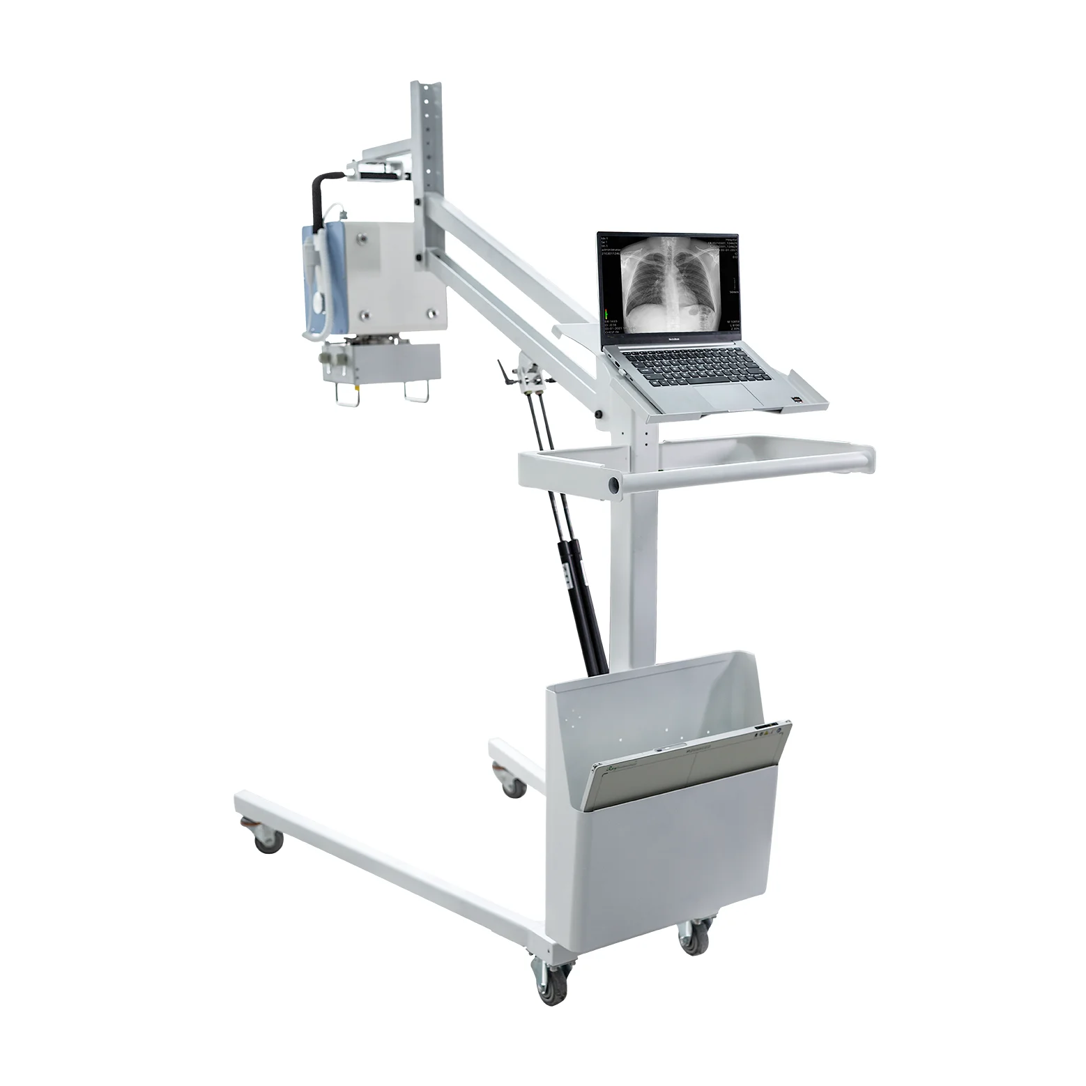 Portable 3.5kW/5.0kW/8.0kW mobile dr system digital xray machine