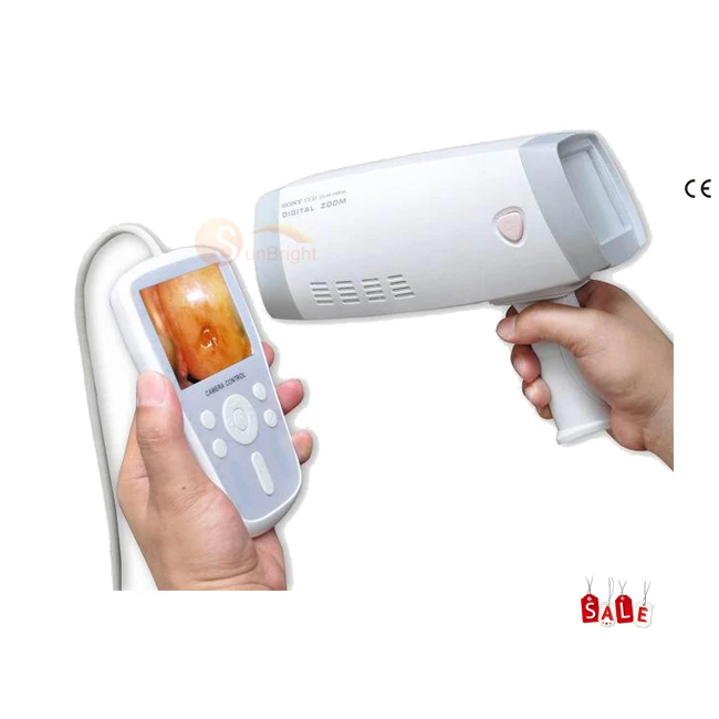 New Digital Colposcope Digital Electronic Video Colposcop Camera gynecological colposcope with Stand colposcopy
