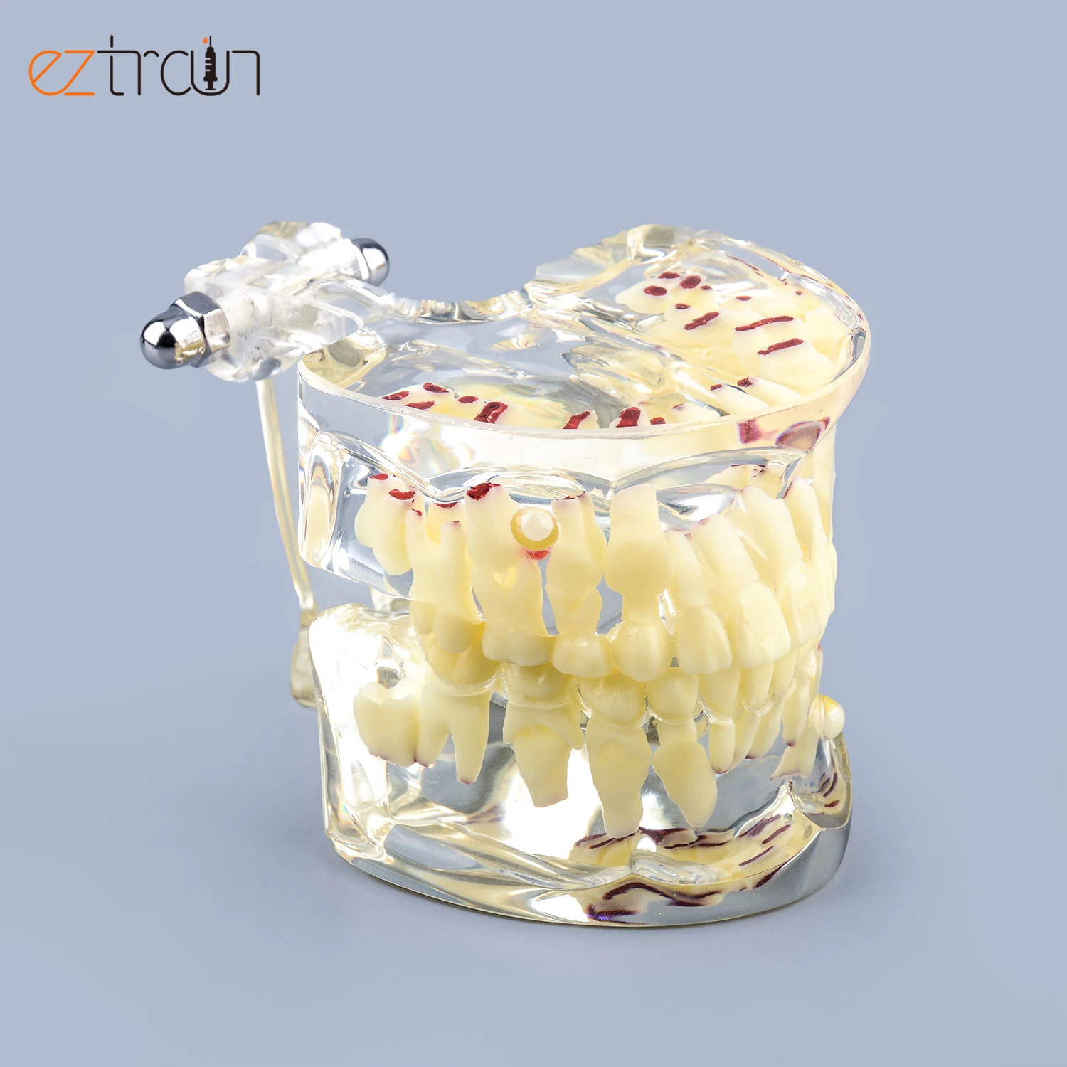 Transparent Dental Implant Model With Nerves For Dental Teaching Transparent Pathological Tooth Model