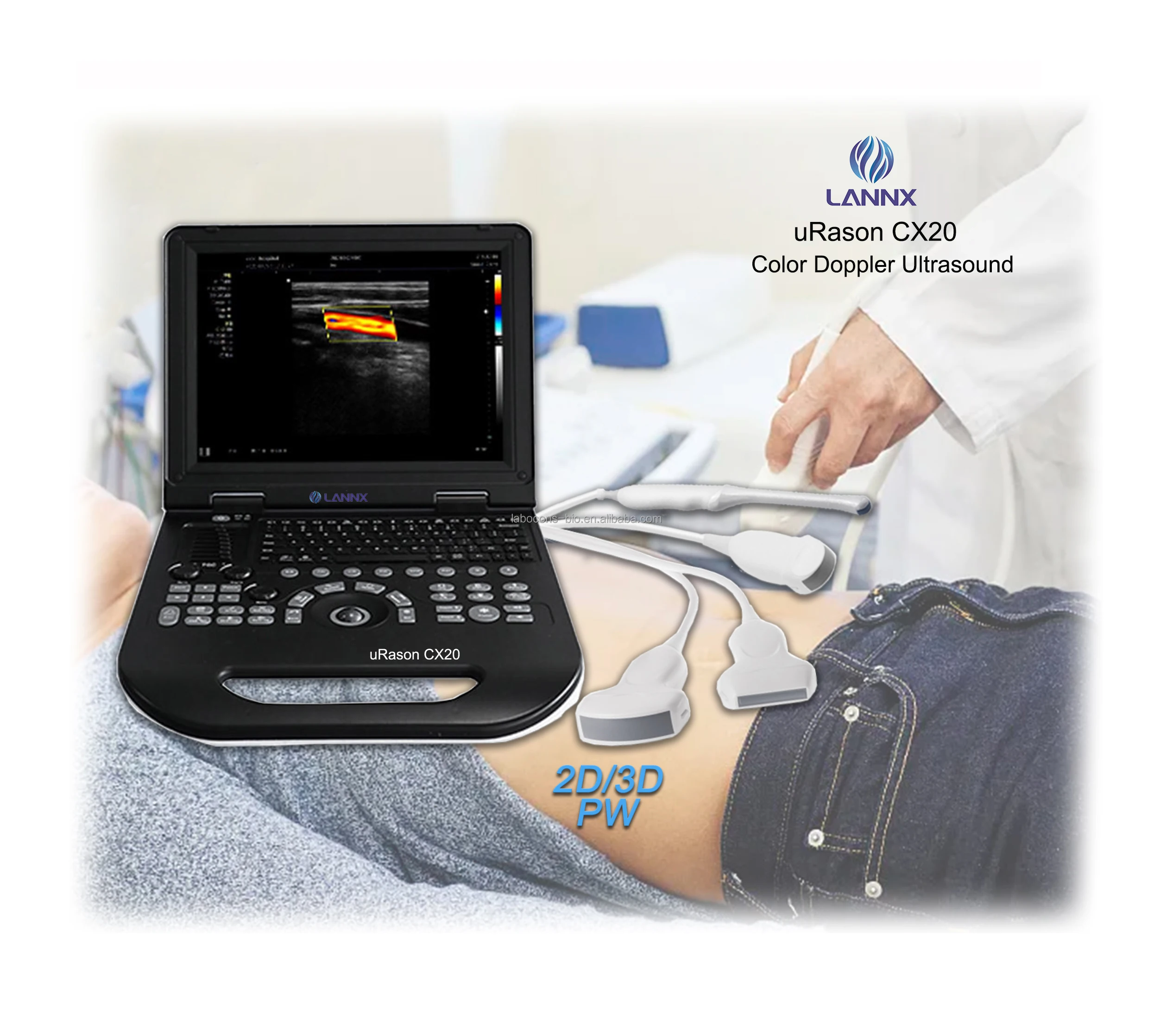 LANNX uRason CX20 больница полный цифровой диагностический Цветной Допплер 2D/3D ультразвуковой аппарат медицинские ультразвуковые инструменты