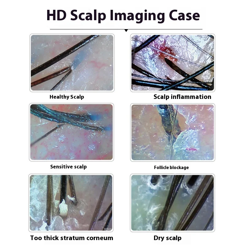 Водонепроницаемая электрическая камера для массажа головы