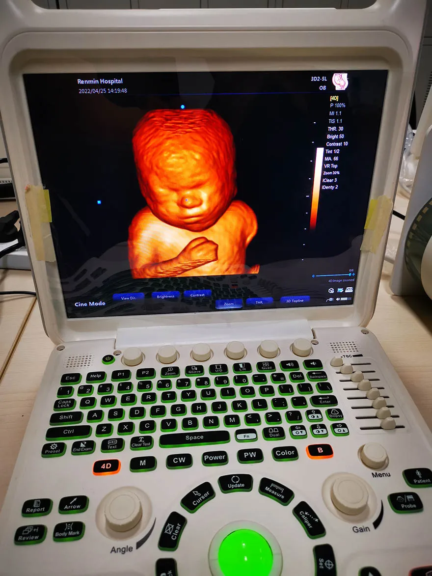 Medical ecografo portatil doppler cardiac 3d 4d ultrasound machine for gynecology