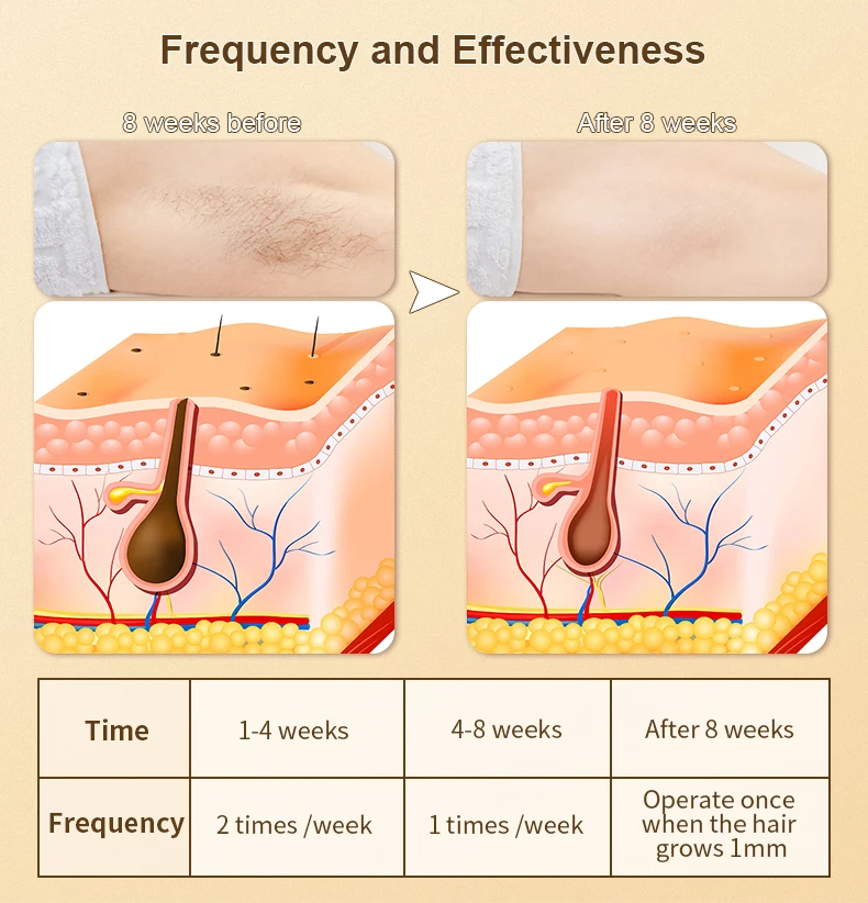 Portable Armpit Arm Bikini Hair Removal Professional Mini Ipl Machine Epilator Hair Removal Appliances For Women Home Use