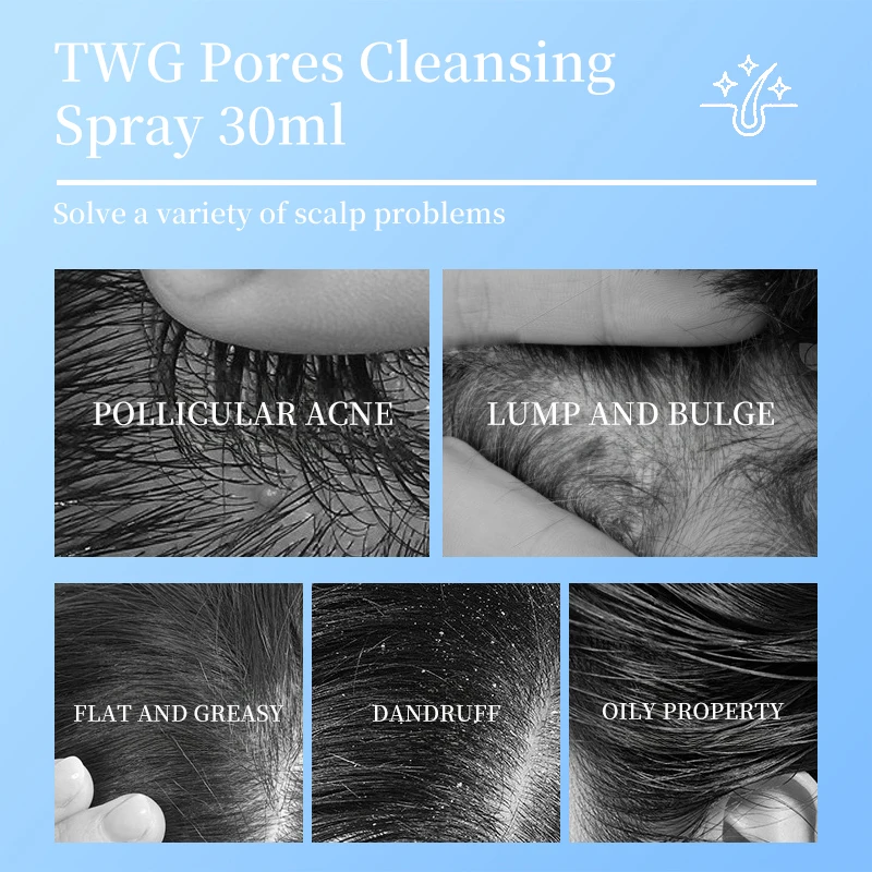 TWG Hair Scalp Anti Dandraff & Anti Itching Pores Refreshing Hair Spray Oil-control Scalp Care Cleansing Scalp Hair Serum
