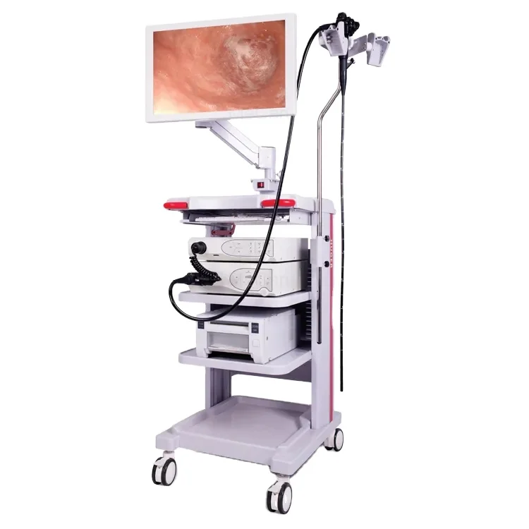 Medical Equipment Endoscopy System With LED Light Source