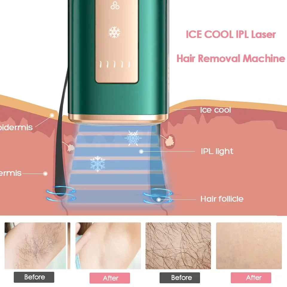 IPL Hair Removal 2023 Sapphire Ice Cooling Haarentferne Laser Hair Remover Epilator