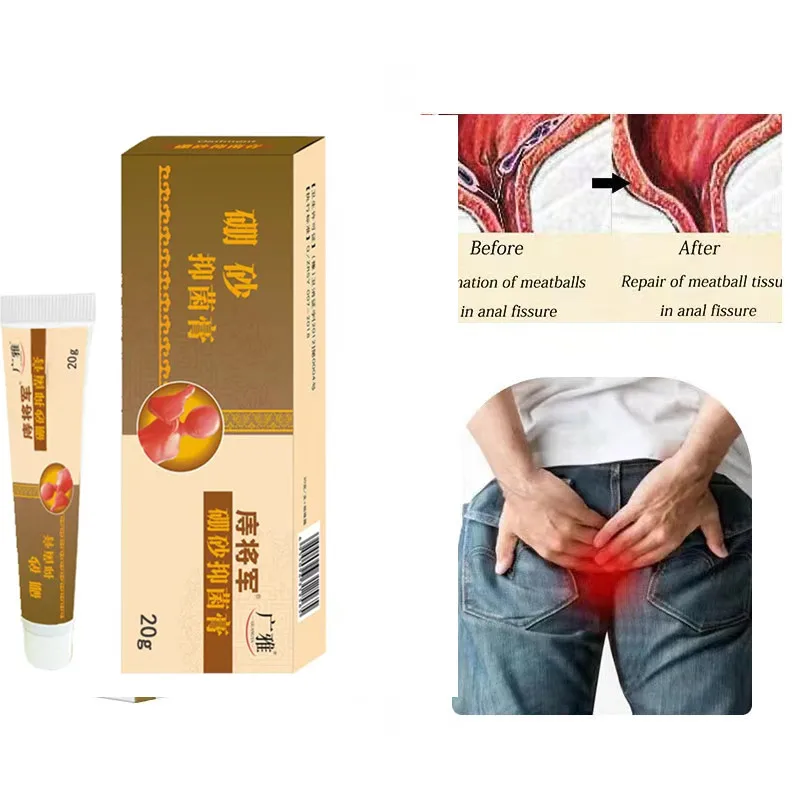 OEM can effectively treat hemorrhoids, internal hemorrhoids, external hemorrh Huatuo Hemorrhoid Cream