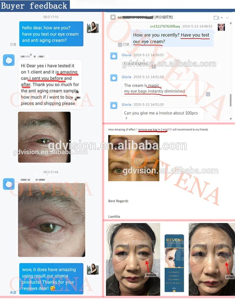 The Best Instant Anti Wrinkle OEM Dark Circles Eye Cream