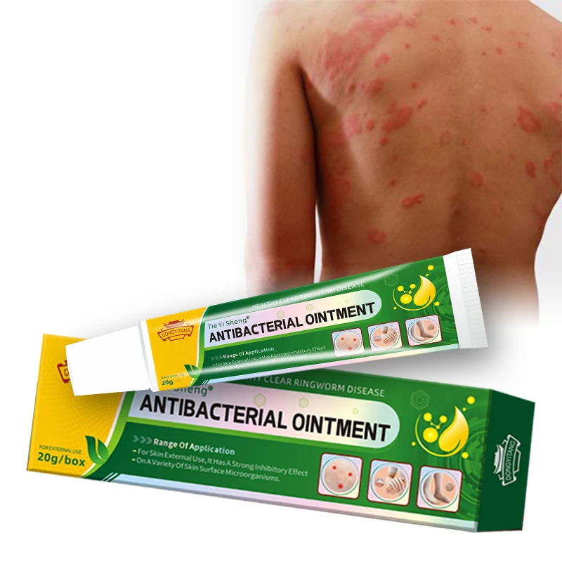 Custom Logo Herbal Green Healthy Skin Care Cream Fungal Infection cream