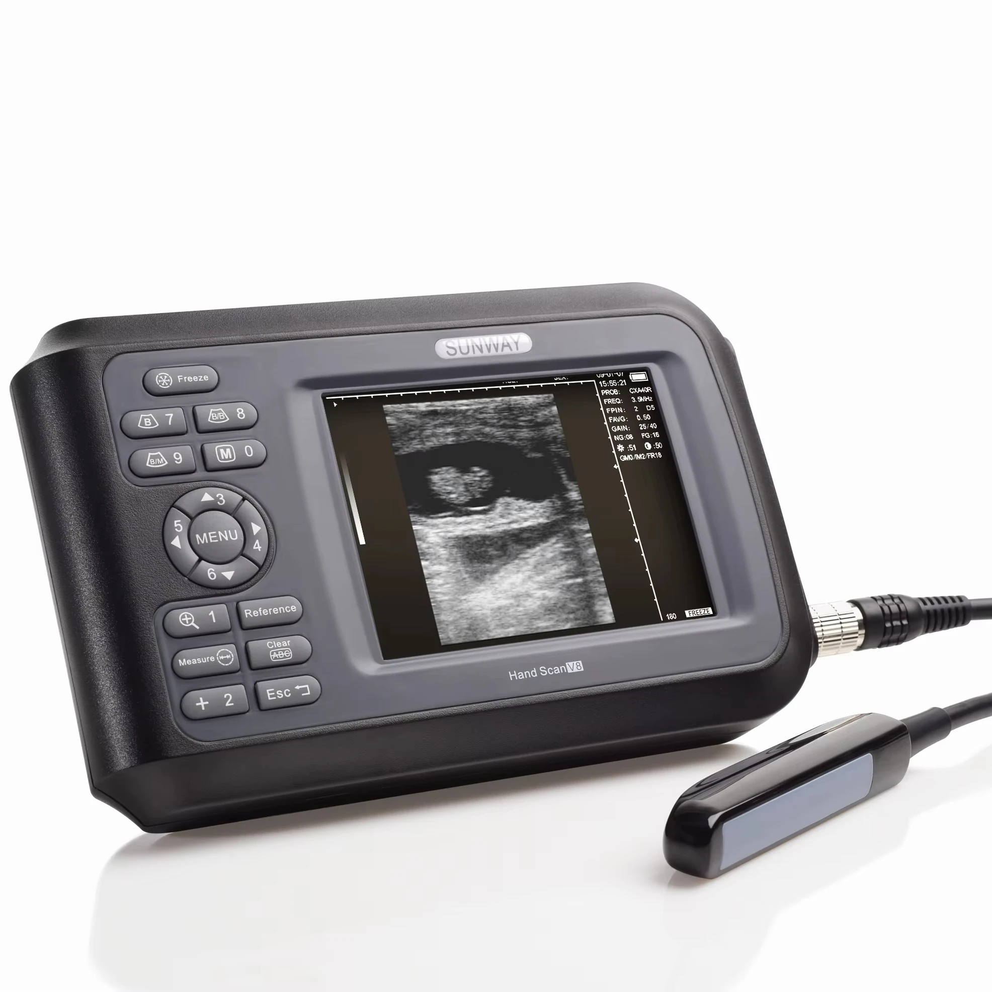 2024, лидер продаж, портативный ветеринарный ультразвук, портативный экологический ультразвуковой