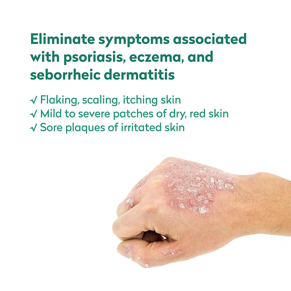 Coal Tar Tea Tree Oil Tcal Cream Soothing Relief Itching Flaking Cracked Skin Antipsoriasis Scar Remover Beauty Personal Care