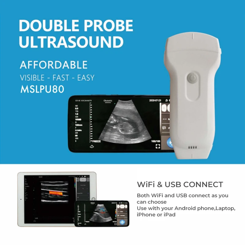 Wh-7 Site-rite Ultrasound Machine  3 In 1  Color Doppler Medical Ultrasound Instruments Wireless WIFI Ultrasonido Portatil