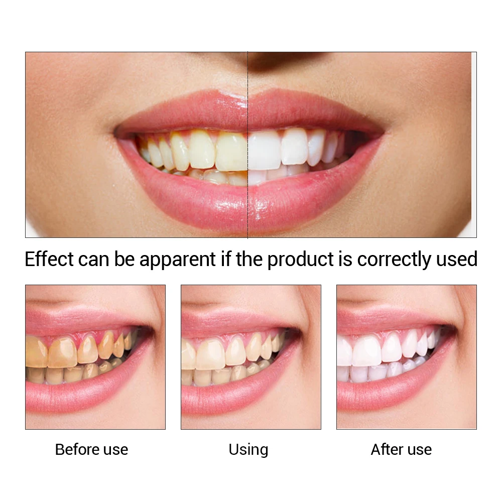 EFERO Teeth Whitening Powder Set Oral Whitening Essence Whitening Plaque Cleaning 10ml wholesale own brand