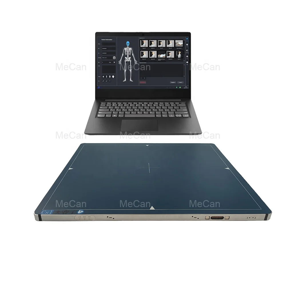 Wireless Vet Direct Dr Cassette Size CR Analog Xray Imaging System Digital Veterinary X Ray Flat Panel Detector