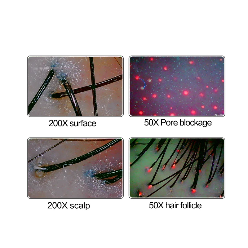 Portable HD Screen Withered Hair Loss Detector Scalp Analyzer / Skin And Analysis