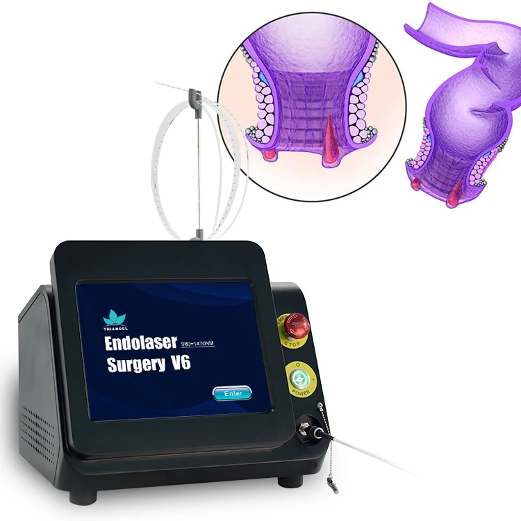 Triangel 980 1470 Diode Laser For Proctology Internal External Mixed Hemorrhoids Treatment Laser Machine