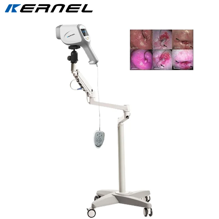 Kernel Optical colposcope Digital Video Vagina Colposcope KN-2200A Colposcope for Gynecology