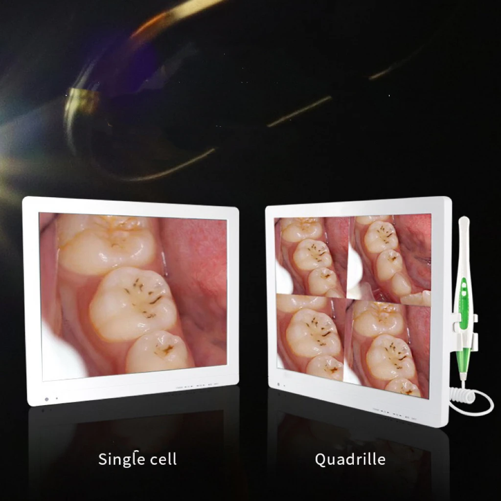 Handheld Dental Camera Oral Endoscope