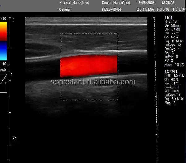 
2020 New Mini Wifi Color Doppler 7.5/10MHz Ultrasound Machine / Wireless Linear Probe 