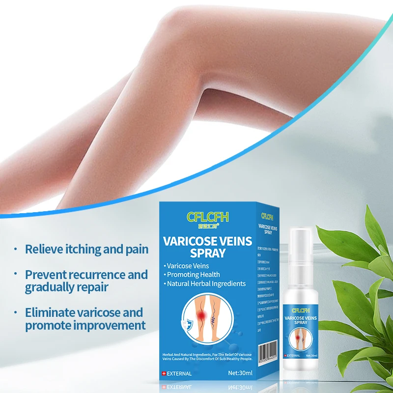 Varicose Vein Spray Spider Varicose Veins Relief cream Herbal Ointment 30ml