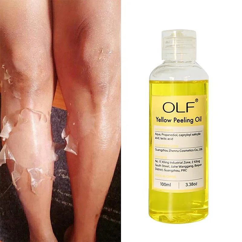 Extra Strength Lowest Price 1 Liter Skin Body Yellow Peeling Oil Face Super Whitening Peeling Oil Lotion