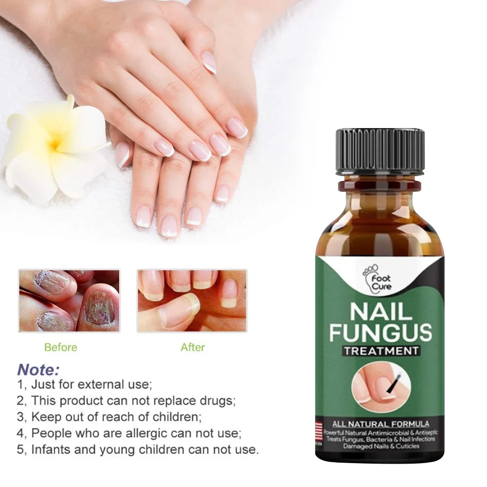 Nail Fungus treatment 10ml foot cure