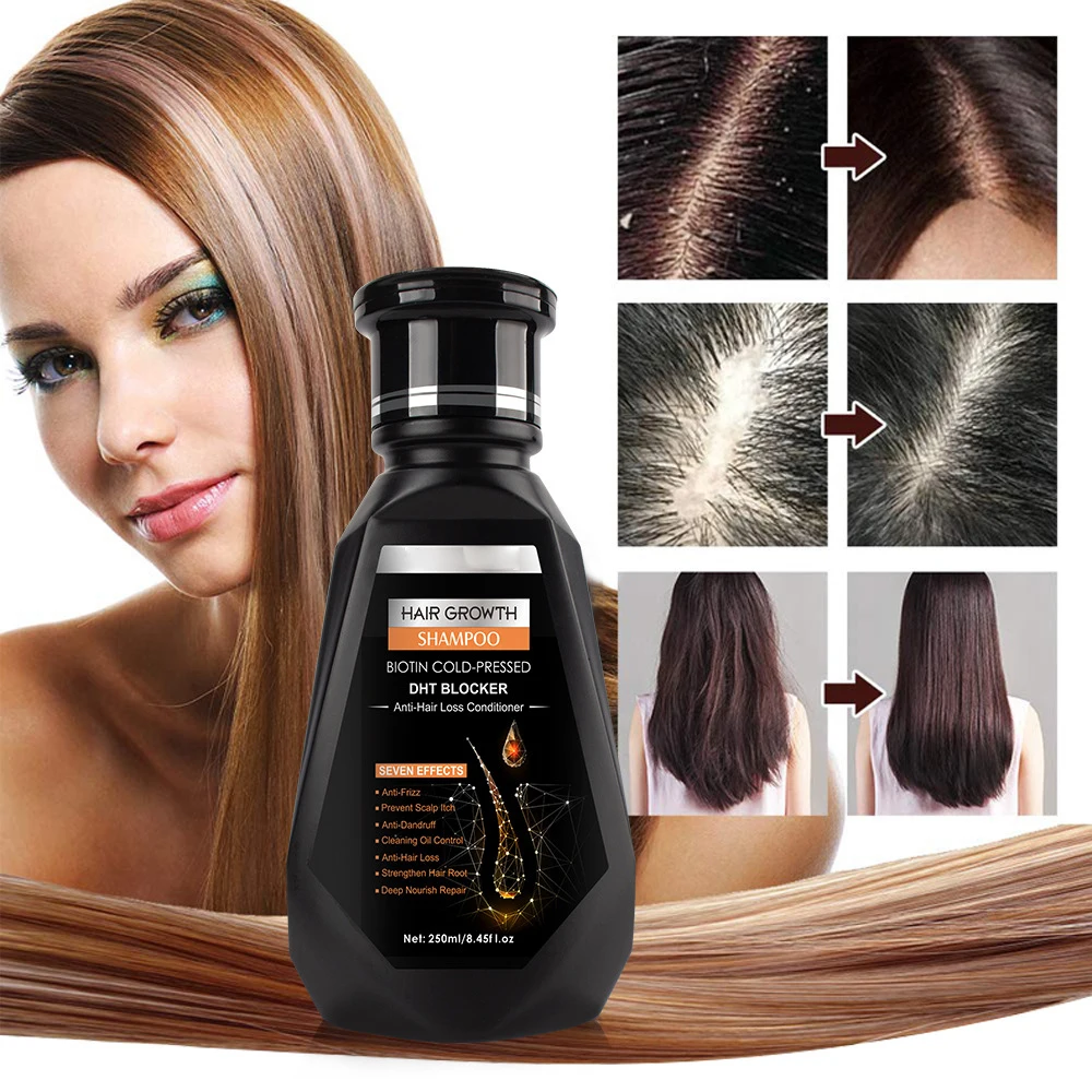 Wholesale anti hair loss treatment repairing Organ chair growth oil for black women private label
