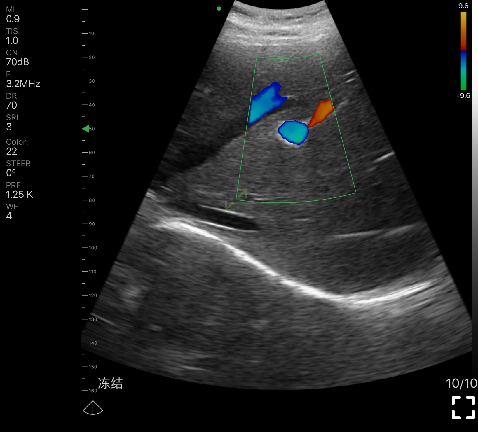 Двойной зонд беспроводной цветной Доплеровский Ультразвуковой сканер Wifi ультразвук MSLPU80