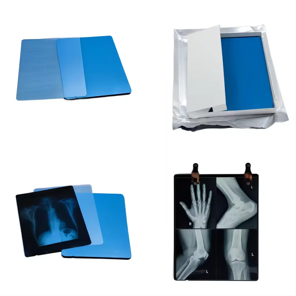 Manufacturer Best Price Medical Thermal PET Matte Dry Film for Medical Image Printout CR DR CT MRI etc