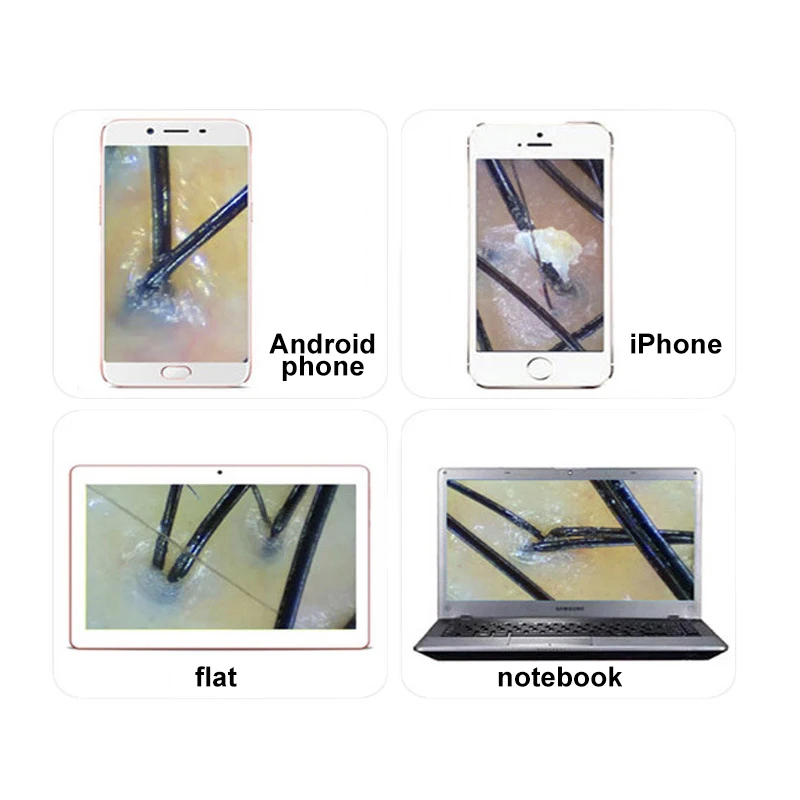 Wireless WIFI Mobile Phone Ipad Scalp Hair Follicle Skin Detector Hair Analyser Machine For Hair Skin Care