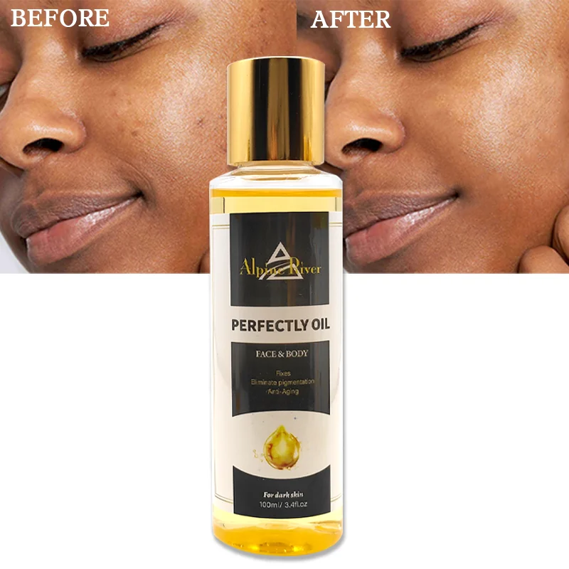 The Most Popular Skin Care Oil Natural Organic Vitamin E Body Whitening Improves Pigmentation Body Massage Oil