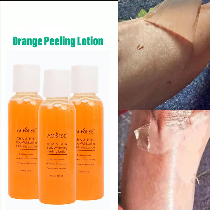 private label body knuckles remover dead extra strong skin whitening exfoliating orange yellow peeling oil