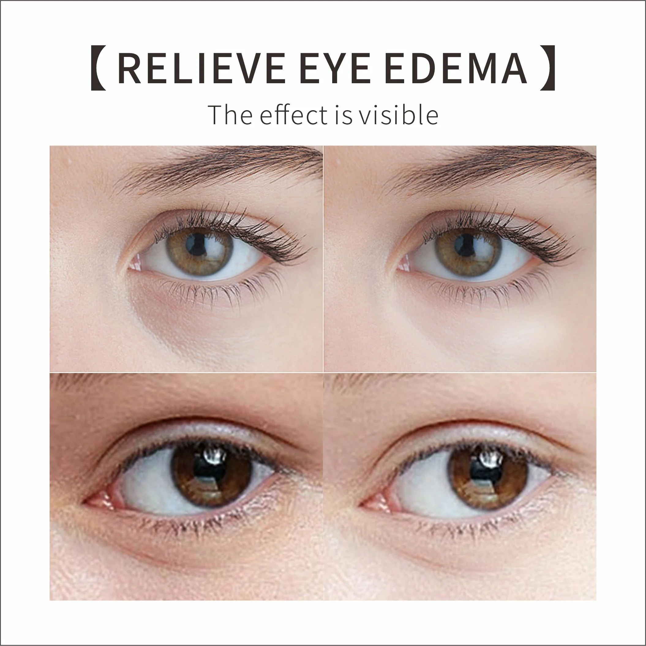 Free Sample 30ml Eye Care Serum Caffeine Solution 5% EGCG Eye Serum Removal Puffiness Dark Eye Circle Whitening Fine Line