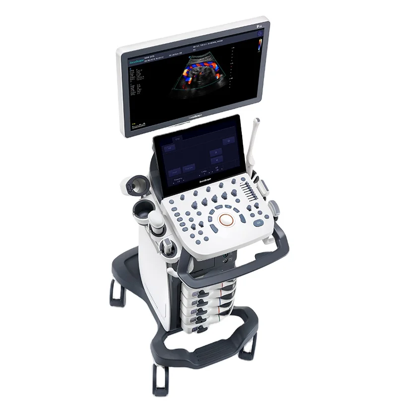  Sonoscape P15 4D/5D корзина цветной ультразвуковой 21 5 