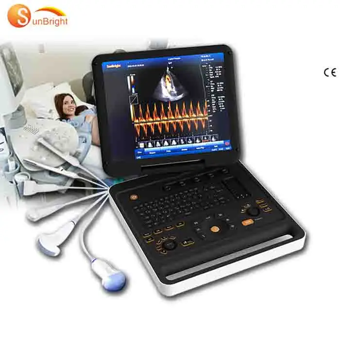 CE 4D one stop whole body diagnosis best image quality color Doppler ultrasound PW CW ultrasound baby