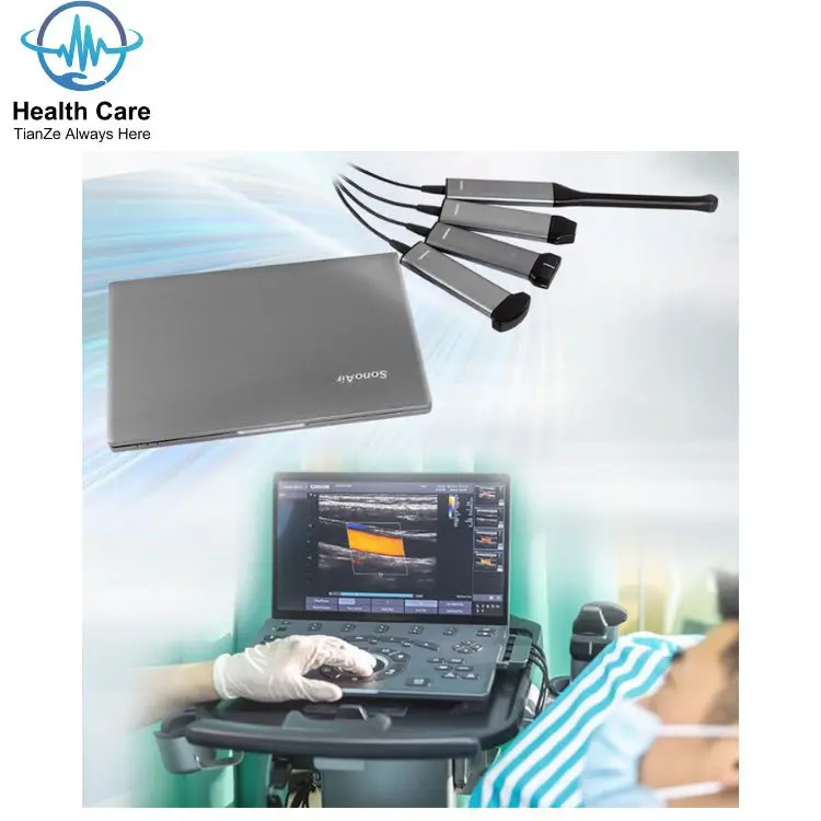 Chison SonoAir 70 Redefine the Future of Portable Ultrasound  perfect combination of powerful and good quality