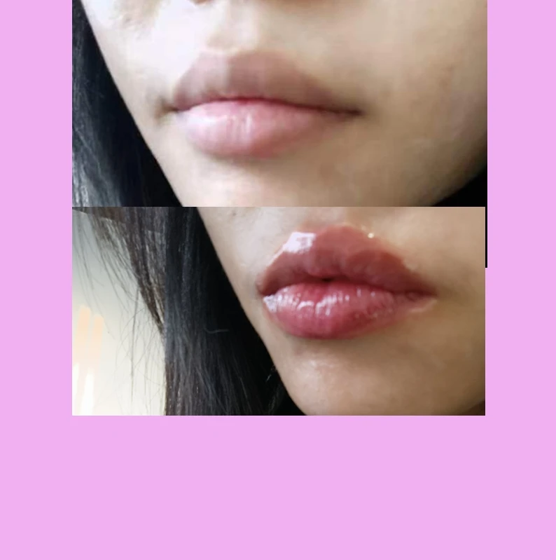 Best lip plumper private label vegan collagen lip plumper set big lipps