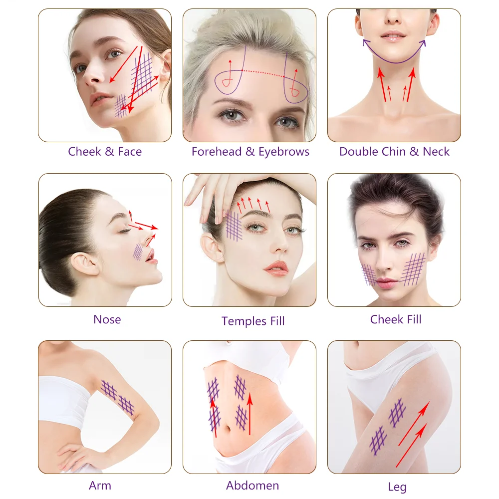 Double Needle Pdo Pcl Plla Thread Nose L Blunt Multi L Fish Bone L/W Blunt Molding Cog Pcl Mesh Thread for Facial Body Lifting