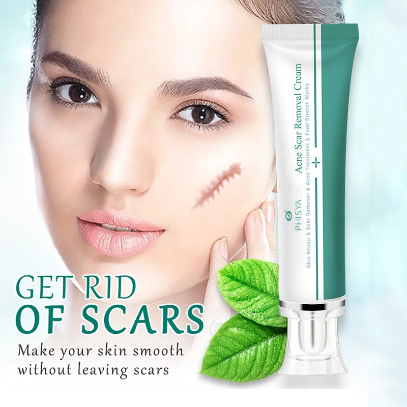 Fades Scar Surgical Scars Treatment Cream Face Pimples Stretch Marks Remove Gel Effective Acne Scar Removal Cream