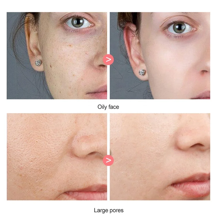 
Private label face skin care facial nourishing serum 