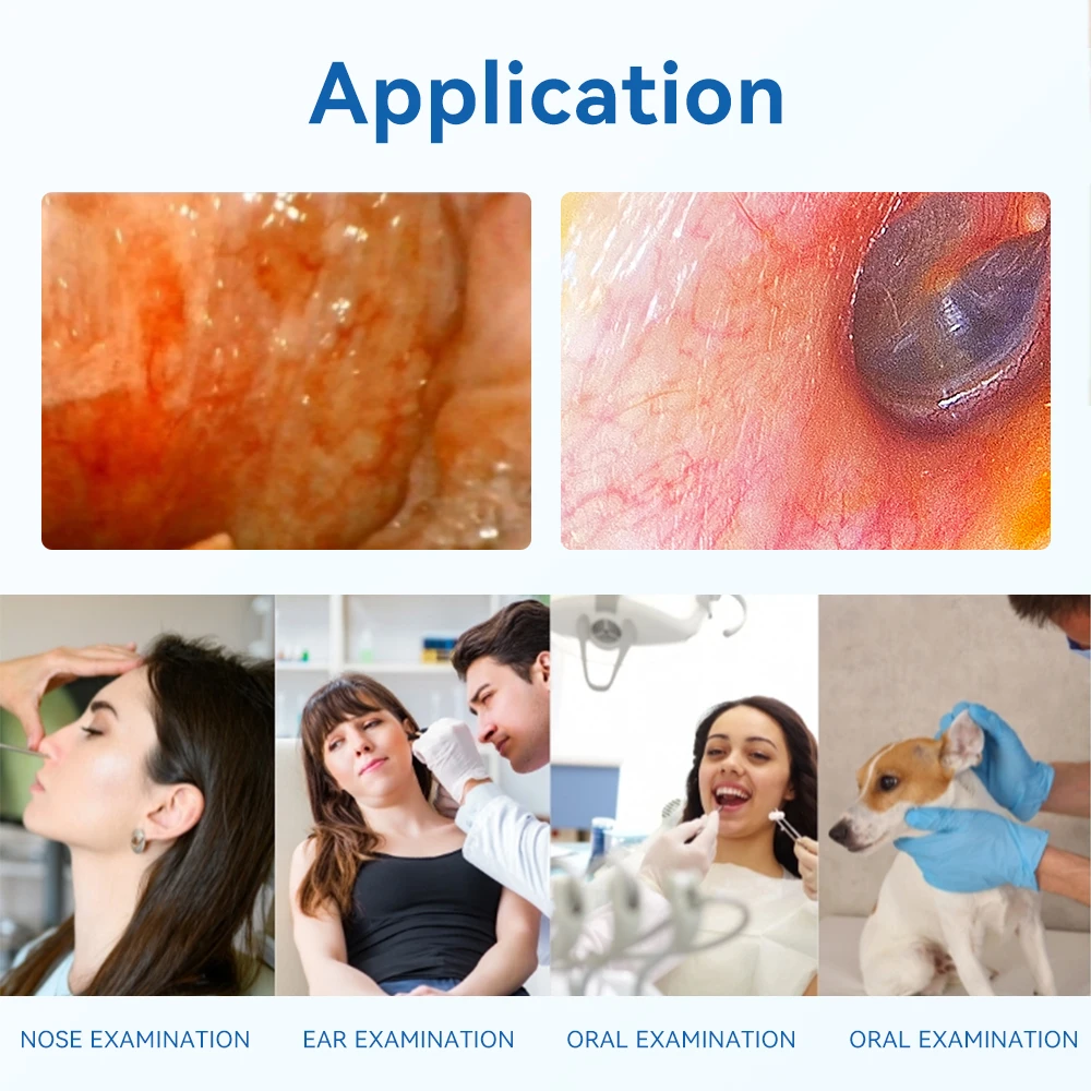 ENT Portable Medical Endoscope Equipment For ENT Diagnosis Teaching Practice OEM/ODM Service Endoscopy Imaging Equipment