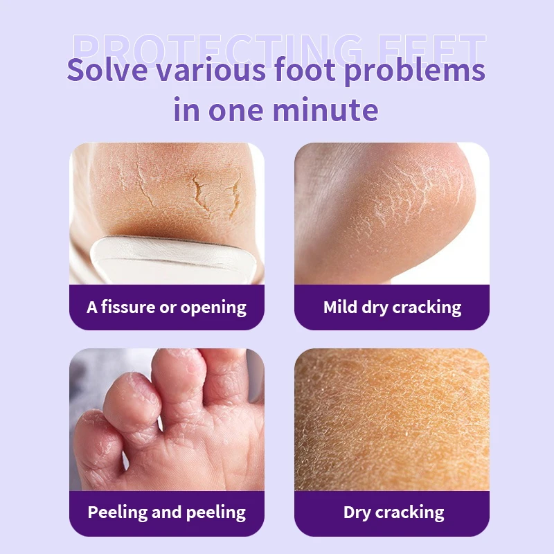 Prevent heel and toe blisters and skin roughness caused by friction whitening repail foot pain relief cream for pain