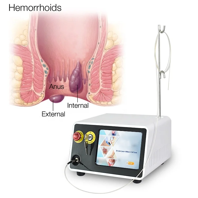 Hot Sale  Proctology Anorectal Hemorrhoids Fistula Laser Surgical Diode Laser 980nm 1470nm